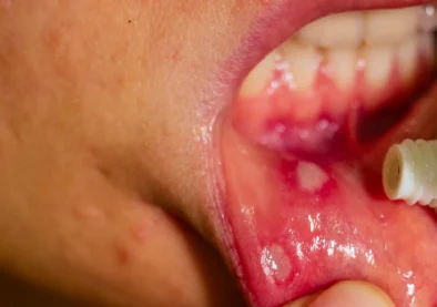 Dental-1 Dental-1
