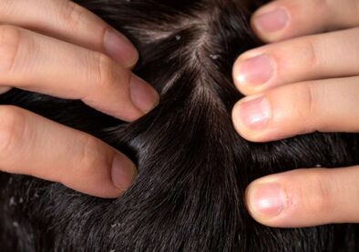 Skin-Hair-Disorders-1