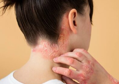 Skin-Hair-Disorders-2