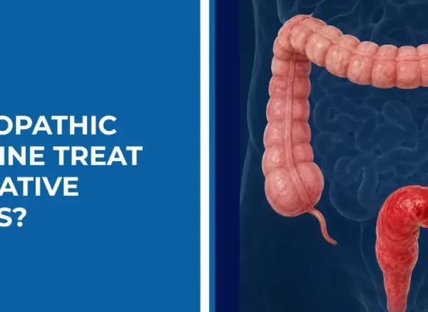 Can Homeopathic Medicine Treat Ulcerative Colitis