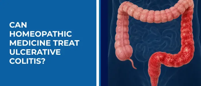 Can Homeopathic Medicine Treat Ulcerative Colitis Can Homeopathic Medicine Treat Ulcerative Colitis