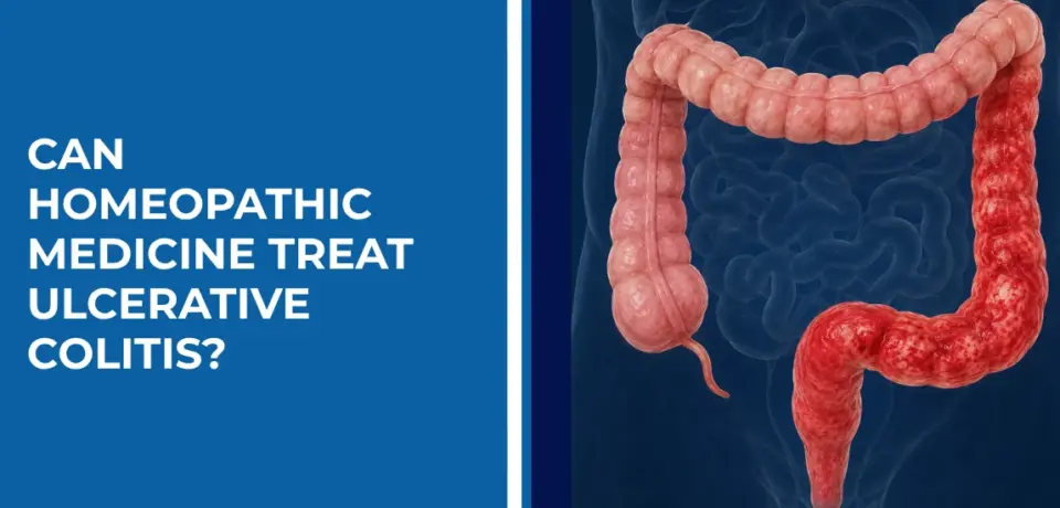 Can Homeopathic Medicine Treat Ulcerative Colitis