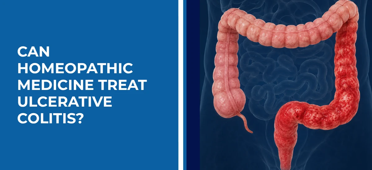 Can Homeopathic Medicine Treat Ulcerative Colitis Healwithin Homeopathy Healwithin Homeopathy Can Homeopathic Medicine Treat Ulcerative Colitis