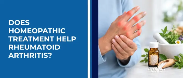 Does Homeopathic Treatment Help Rheumatoid Arthritis Does Homeopathic Treatment Help Rheumatoid Arthritis