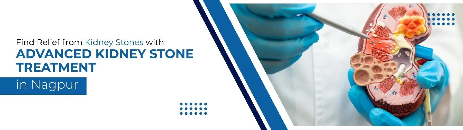 Find Relief from Kidney Stones with Advanced Kidney Stone Treatment in Nagpur Healwithin Homeopathy Healwithin Homeopathy