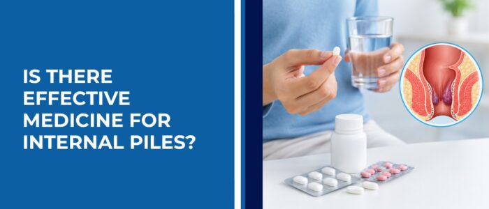 Is There Effective Medicine for Internal Piles